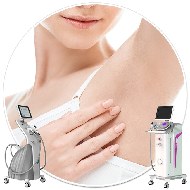 epilare definitiva laser axile