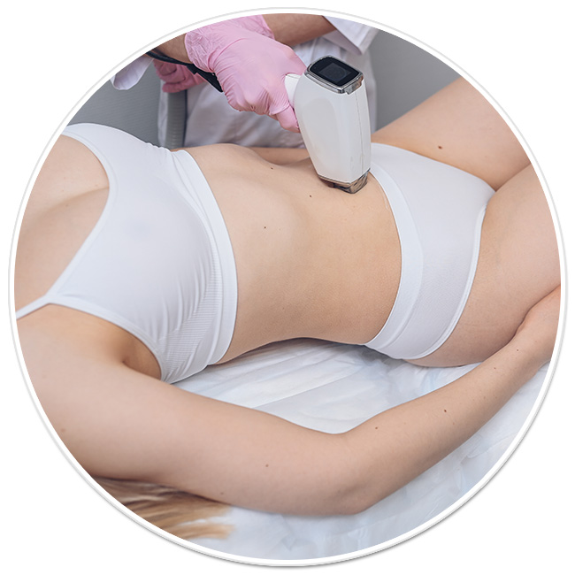 epilare definitiva laser axile