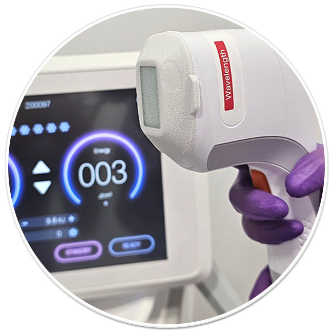 epilare definitiva laser axile