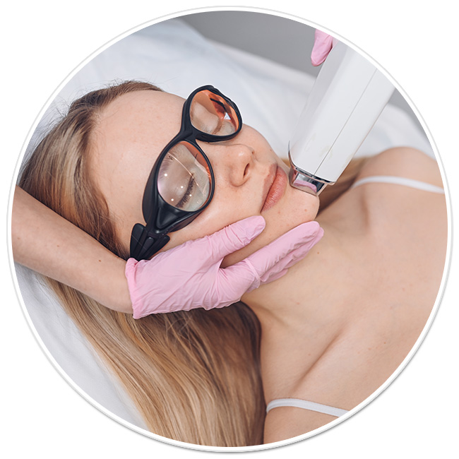 epilare definitiva laser axile