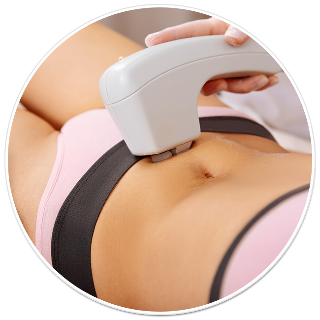 epilare definitiva laser axile