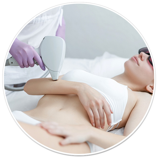 epilare definitiva laser axile