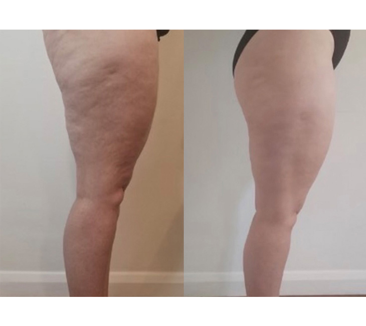 Typhoon 2.0 - Aplicatoare